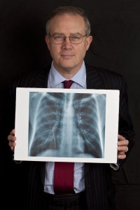 John Baron MP encourages lung cancer awareness